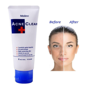 Mistine Acne Clear Face wash